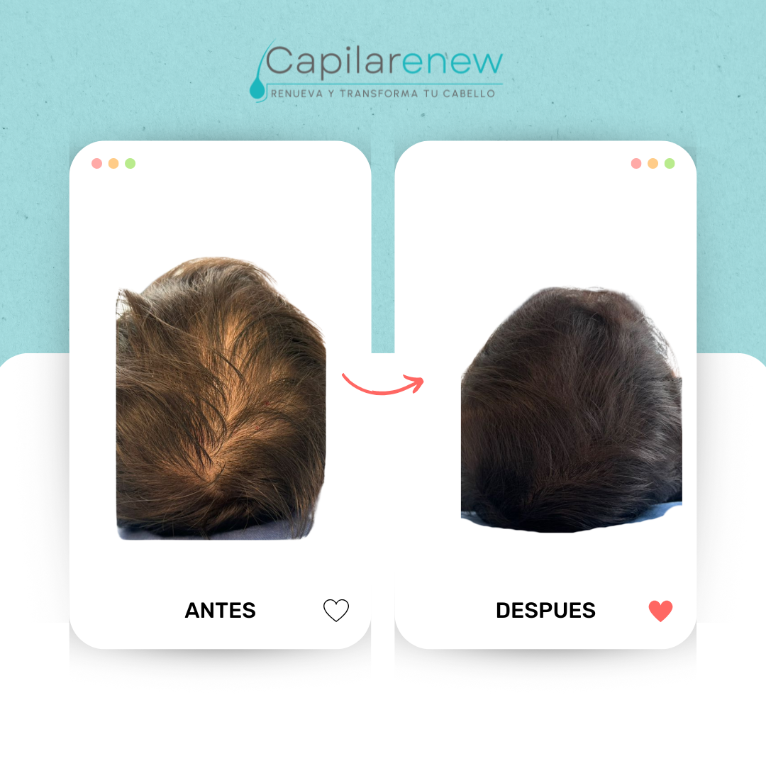 Testimonios Tónico Capilar