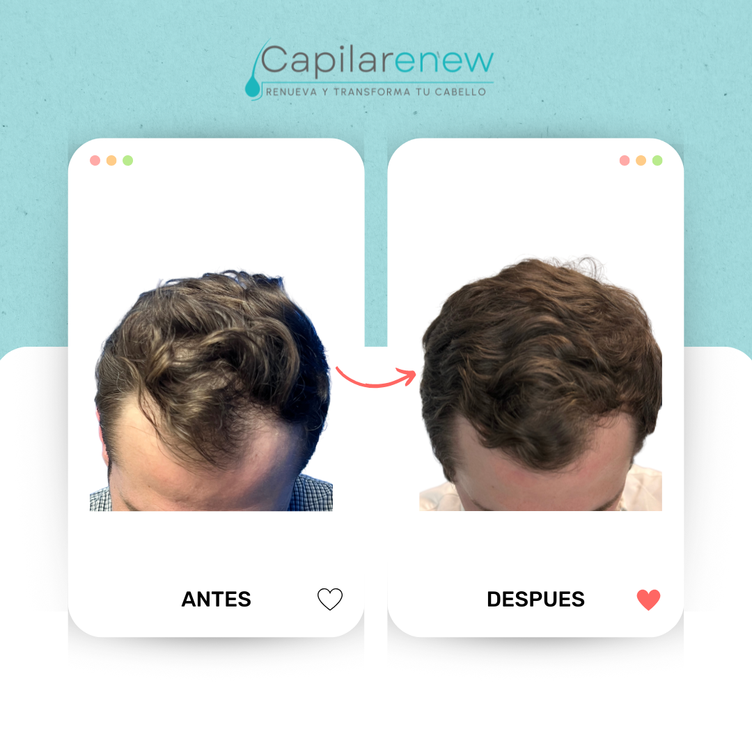 Testimonio Capilarenew