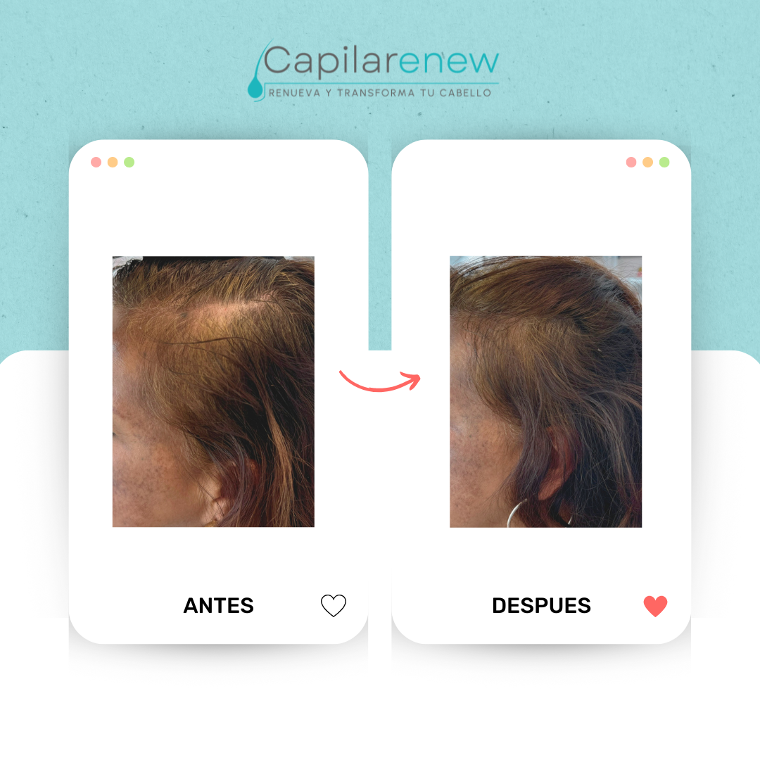 Tonico Capilar testimonio